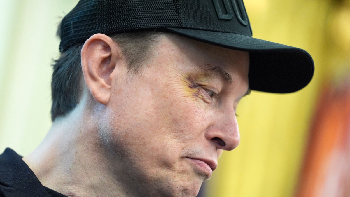 Musk appears with bruise near right eye at Oval Office, says his son X ‘punched’ him in face; Trump reacts